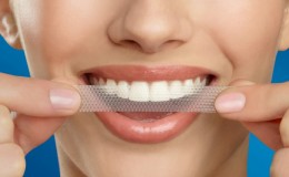 Best teeth whitening strips
