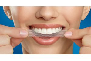 Best teeth whitening strips